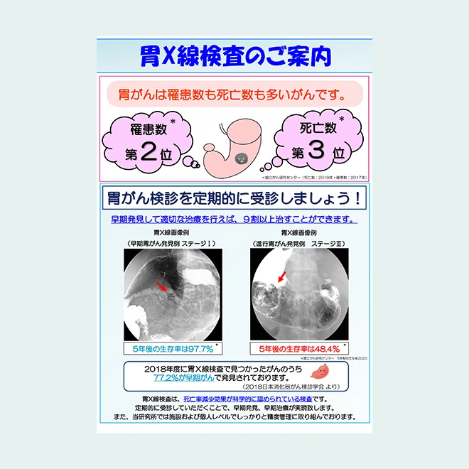 胃Ⅹ線検査のご案内